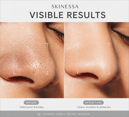 Pore Perfect Clay Stick Mask